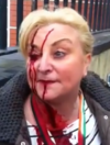 Woman left bloodied after gardaí attempt to move anti-water charge protesters