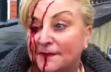 Councillor says protest organisers to blame for woman's injuries - not gardaí