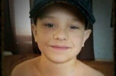 This little boy was 'afraid people would think he's ugly' because of his surgery scars...until now
