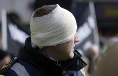 Head-butts, bites and a broken nose - but no jail time for garda attackers