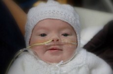 A young girl is cutting her hair off today to help raise money for this little guy