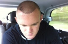Rooney's team-mates think his hair transplant makes him a better player