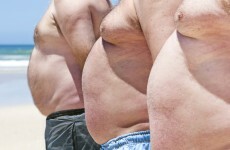 Why is Ireland so fat? Here's what an expert thinks