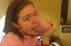 This girl's tongue is so long she can actually lick her elbow