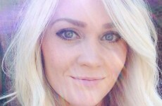 Woman's graphic skin cancer treatment photo goes viral