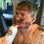 This man's mates glued their pubic hair to his face for a stag party