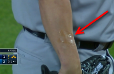 Pitcher gets ejected for having a blatantly obvious foreign substance on his arm