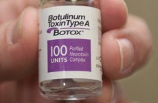 New use for Botox in Ireland