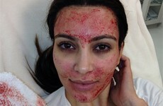 Women are now injecting their own blood into their vaginas to tighten them up