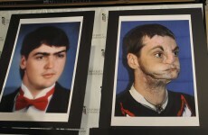 3 Midweek Longreads: 'I used to tell bullies I was mauled by a tiger at the zoo'