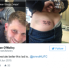 This lad got 'Gary Lineker shags crisps' tattooed on his arse, and immediately regretted it