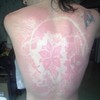People are getting sunburned on purpose for 'sunburn tattoos'