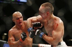 Rory MacDonald's face is seriously messed up after his epic UFC 189 rematch