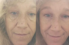 A new 'miracle' cream claims to smooth out wrinkles in seconds -- but is it too good to be true?
