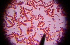 New social network matches friends by... intestinal bacteria