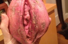 'Vagina contouring' is the latest (and scariest-sounding) fanny beauty trend