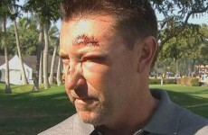 Former caddie claims Robert Allenby's Hawaii kidnapping story isn't true