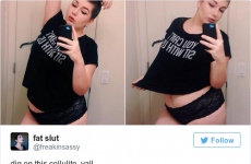 9 things you always wanted to know about cellulite, but were too afraid to ask