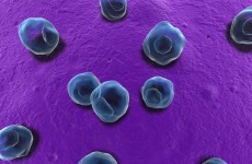 There's been a surge in Irish Chlamydia cases
