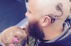 This dad made a lovely gesture for his daughter who was insecure about her cochlear implant