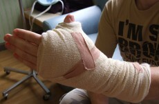 In pictures: Man who had thumb surgically replaced with big toe
