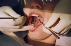 Dentists offer free checks for mouth cancer
