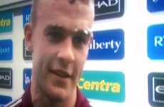 'What answer do we really expect?' How Galway reacted to THAT Johnny Glynn interview