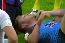 Nasty rugby league shoulder to the face results in a red card