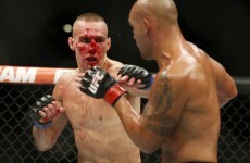 MacDonald describes brutal UFC 189 loss as 'the greatest moment of my life'