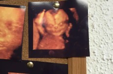 A couple's freaky 4D sonogram is creeping the internet out