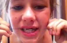 Teens are making their own painful braces in the latest bizarre online trend