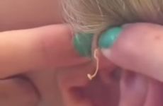 Watch this video of a girl popping a 6-year-old spot IF YOU DARE