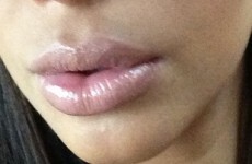 Kim Kardashian says she has 'pregnancy lips' -- but is that even a thing?