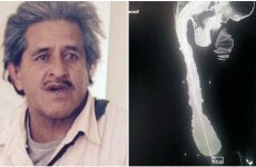The man with the longest penis in the world says it's really not all that
