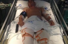 Family struggling with costs after son (20) breaks his back diving into Ibiza pool