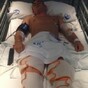 Family struggling with costs after son (20) breaks his back diving into Ibiza pool