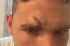 Here's our first look at the injury that postponed the Lee v Saunders title fight