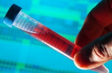 Leo Varadkar has called for an increase in HIV testing in Ireland