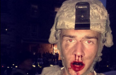 A broken leg and 24 concussions. Pillow fights among US recruits are hardcore