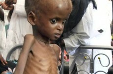 Somali government bans foreign workers from delivering aid