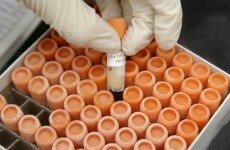 Irish patients scammed by bogus stem cell therapies abroad