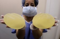 Hundreds of Irish women could have contaminated breast implants