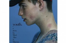 The Irish lad on the cover of Italian Vogue has explained THAT hickey on his neck