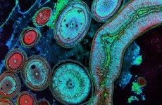 Irish-born scientist given a Nobel Prize for his work fighting a horrible parasite