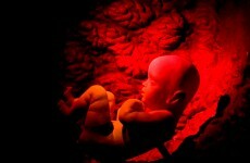 Babies of overweight mothers 'get fatter in the womb' - study