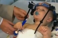 Toddler's head reattached after internal decapitation