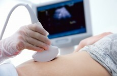 Expectant mothers experienced 75 'extreme' incidents in Irish hospitals last year