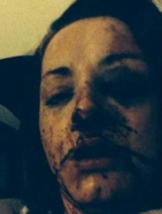 "It was quite a picture": Woman knocked unconscious for two days by ex-partner