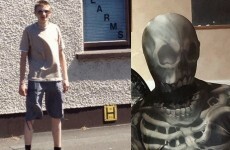 Police in the north are "increasingly concerned" for a man who went missing on Halloween