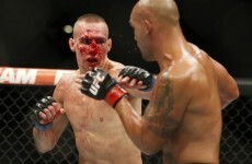 Study claims that boxing poses greater risks of serious injury than MMA